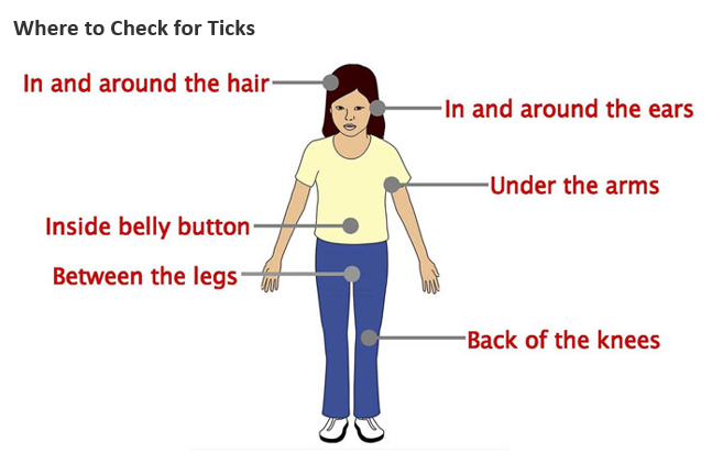 where-to-check-for-ticks-diagram